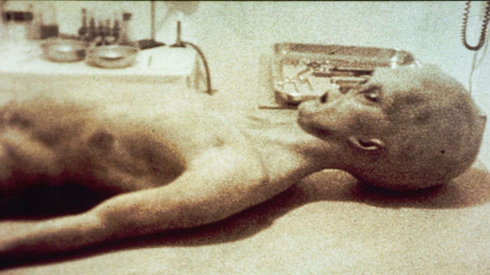 The Alien Autopsy Background